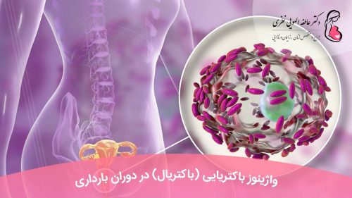 واژینوز باکتریایی