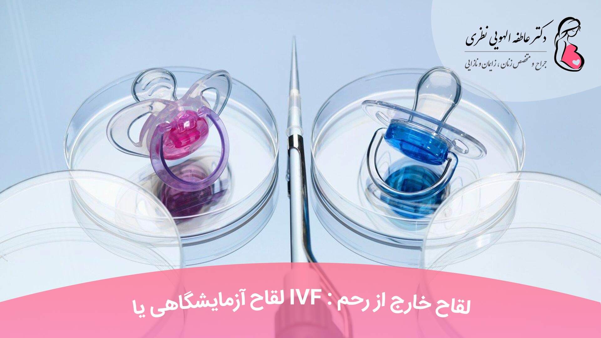 لقاح آزمایشگاهی یا IVF : لقاح خارج از رحم