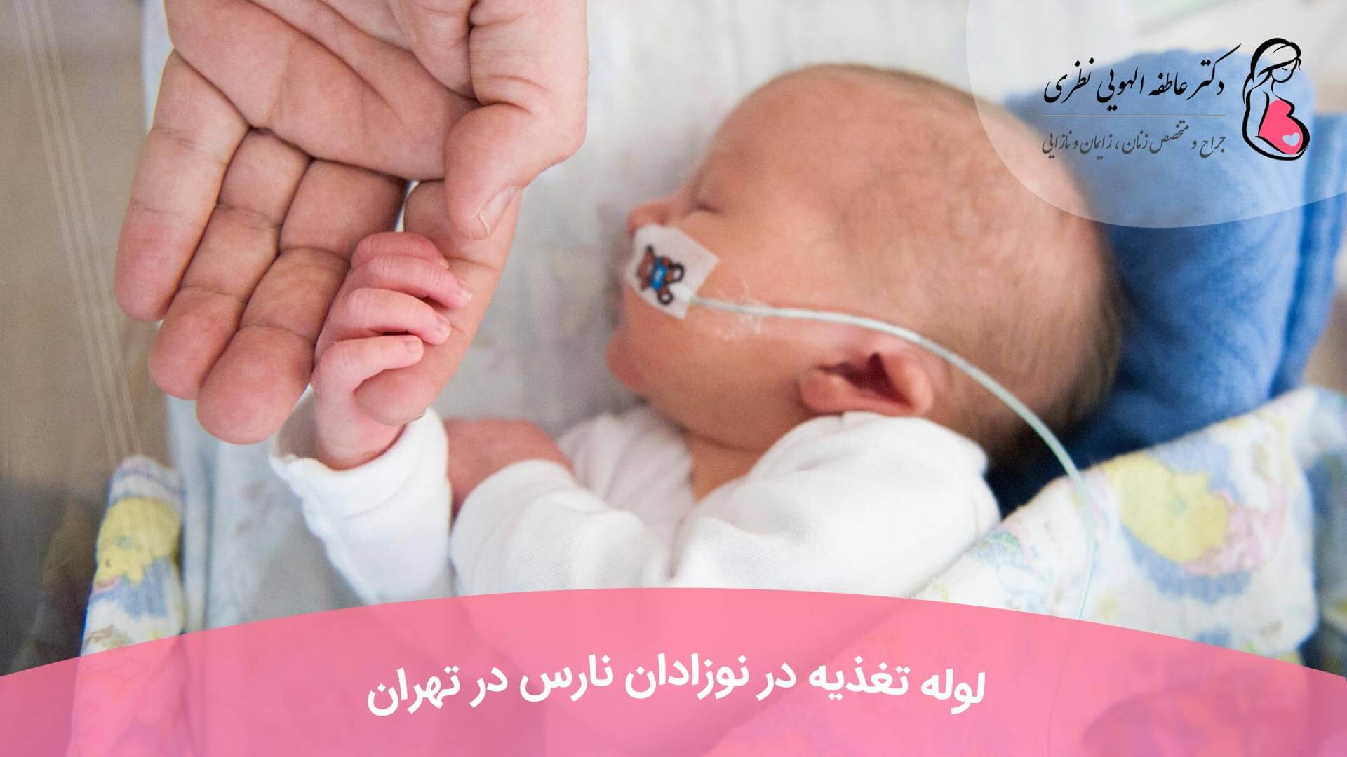 لوله تغذیه در نوزادان نارس در تهران