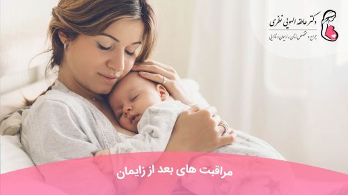 مراقبت های بعد از زایمان