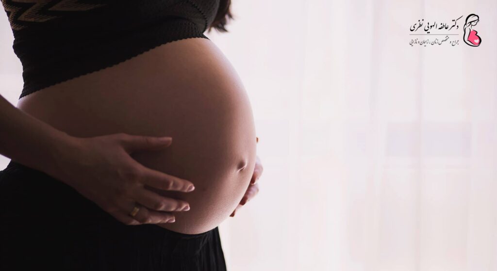 زایمان و وضعیت بریچ جنین