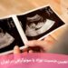 تعیین جنسیت نوزاد با سونوگرافی