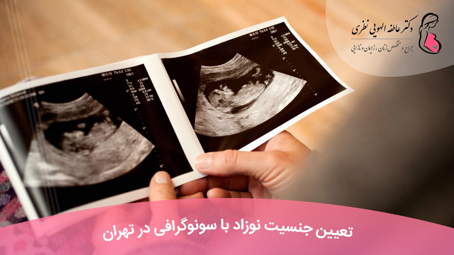 تعیین جنسیت نوزاد با سونوگرافی