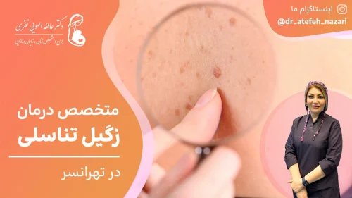 متخصص درمان زگیل تناسلی در تهرانسر