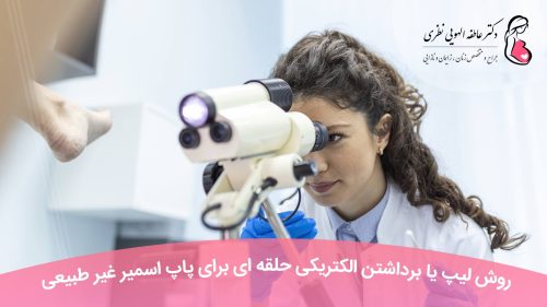 روش لیپ (LEEP) یا برداشتن الکتریکی حلقه ای برای پاپ اسمیر غیر طبیعی