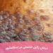درمان زگیل تناسلی در اسلامشهر