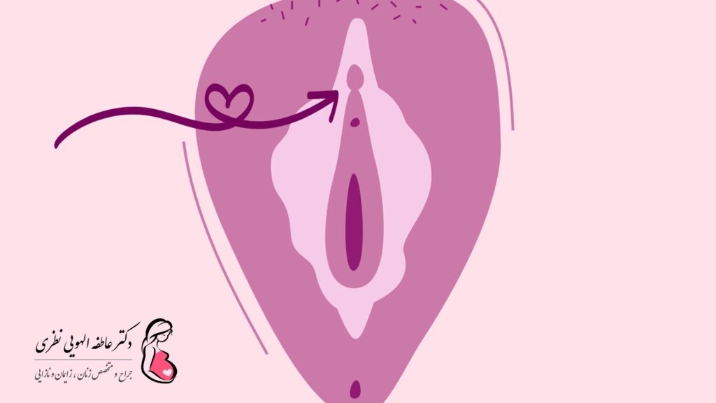 جراحی زیبایی واژن در کرج