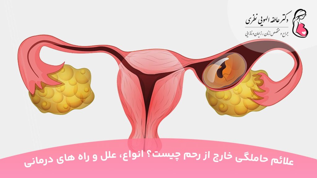 علائم حاملگی خارج از رحم چیست