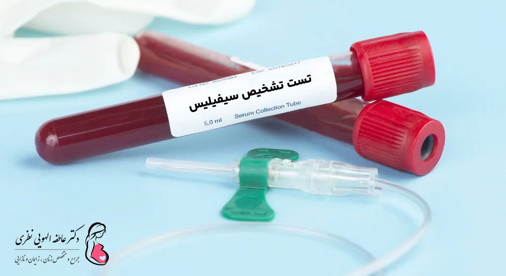 آزمایش خون برای تشخیص سیفیلیس