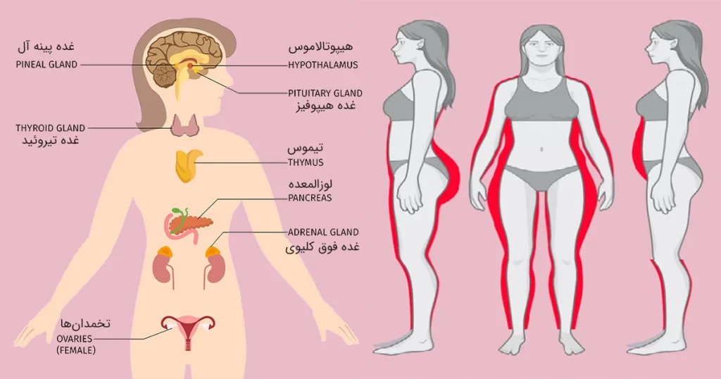 غدد نواحی مختلف بدن زنان