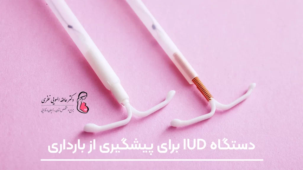 دستگاه IUD برای جلوگیری از بارداری زنان