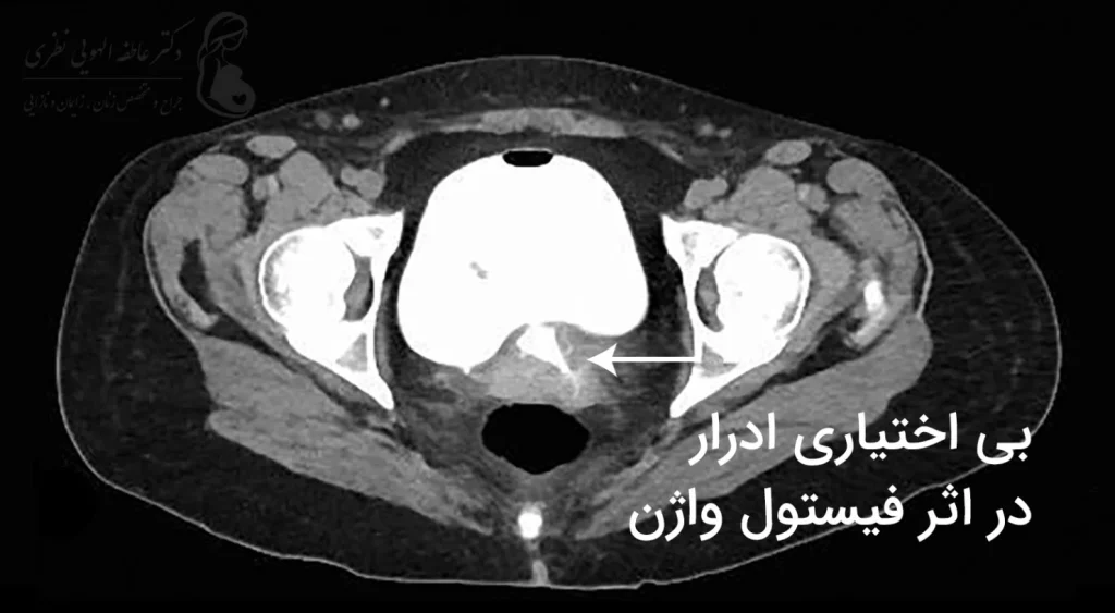 تصویر MRI واژن زنان