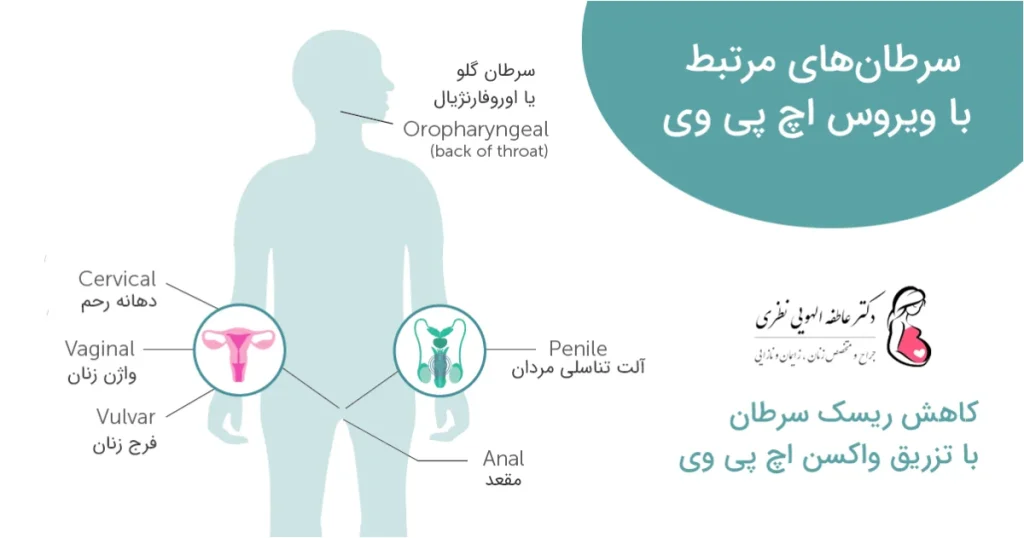 سرطان های ویروس اچ پی وی