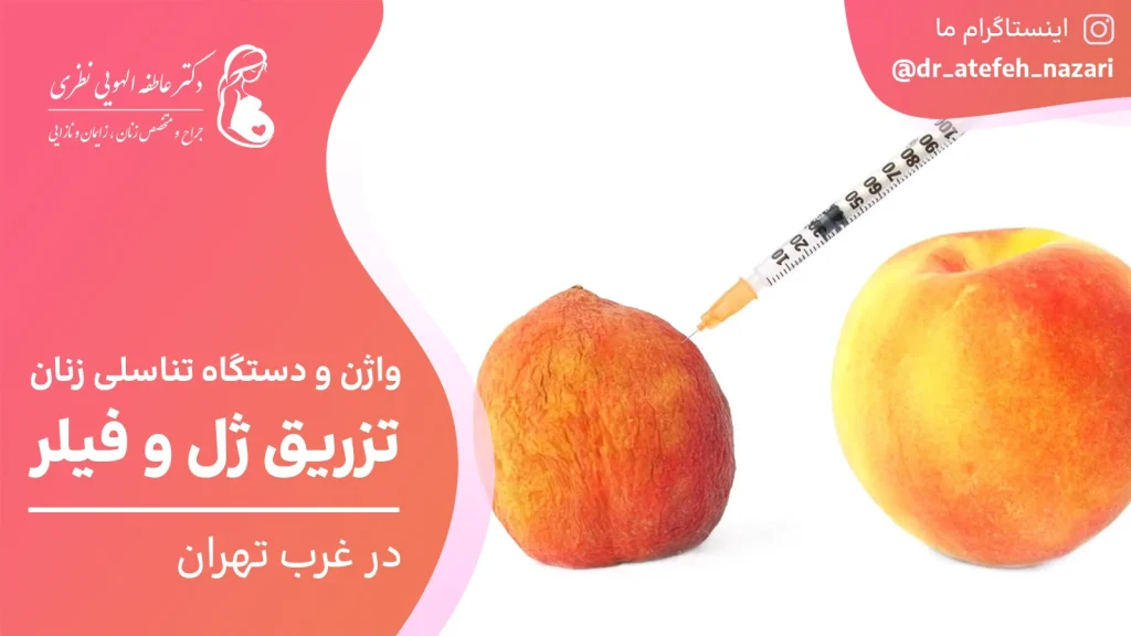 تزریق ژل و فیلر واژن در غرب تهران