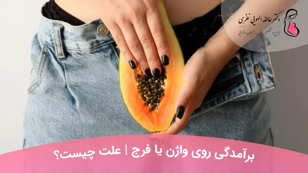 برآمدگی روی واژن و فرج